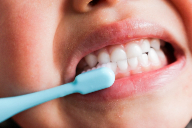 歯並びの悪さは単に見た目だけでなく、歯がガタガタに並んでいることによってブラッシングしても磨き残しが出やすく、虫歯や歯周病のリスクを高めます。
